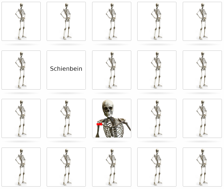 ZoomedPreview