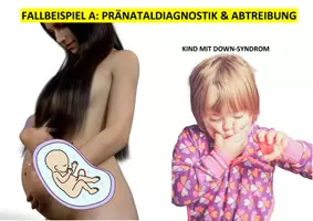 Vorschau - Stundenentwürfe - Einführung in die Bioethik (AB 1 Bioethik) - Seite 3