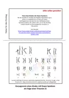 Vorschau - Arbeitsblätter - Arbeitsmaterial Trisomie 21 Down-Syndrom differenziert - Seite 1