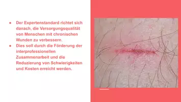 Vorschau - Präsentationen/Tafelbilder - Expertenstandard chronische Wunden - Seite 3