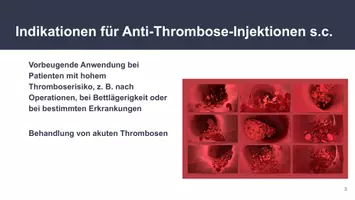 Vorschau - Präsentationen/Tafelbilder - Anti-Thrombose-Injektionen für Pflegehelfer - Seite 2