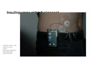 Vorschau - Präsentationen/Tafelbilder - Umgang mit Insulinpumpen - Seite 2