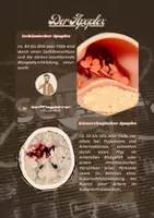 Vorschau - Poster - One Minute Wonder zu den Ursachen eines Schlaganfalles - Seite 1