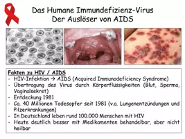 Vorschau - Stundenentwürfe - HIV / AIDS - Unterrichtsmaterial Oberstufe - Seite 1