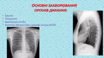 Попередній перегляд - Дихальна система - Сторінка 2