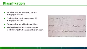 Vorschau - Arbeitsblätter - Materialpaket Herzrhythmusstörungen - Seite 3