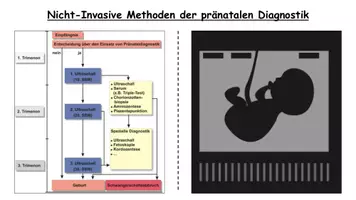 Vorschau - Stundenentwürfe - Pränataldiagnostik: Methoden, Risiken und Ethik – Unterrichtsstunde Sekundarstufe II - Seite 1