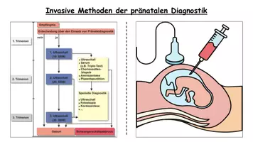 Vorschau - Stundenentwürfe - Pränataldiagnostik: Methoden, Risiken und Ethik – Unterrichtsstunde Sekundarstufe II - Seite 2