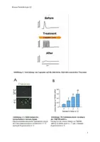 Vorschau - Test - Klausur Biologie Q1: Neurobiologie - Seite 3