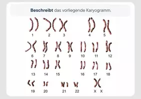 Vorschau - Stundenentwürfe - ES 9 - Mutation - EF - Genetik - Seite 2