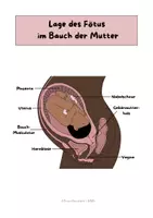 Vorschau - Arbeitsblätter - Sexualerziehung (Schwangerschaft, Geburt und Säuglingspflege) Materialpaket - Seite 3