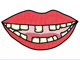 Vorschau - selbst erstellte Cliparts/Grafiken - Cliparts gesunde Zähne/ungesunde Zähne - Seite 1