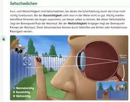 Vorschau - Spiele - Die Augen, Sehschwächen (interaktiv) - Seite 2