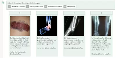 Vorschau - Interaktives Material - Gesunderhaltung des Skeletts, richtige Haltung (interaktiv) - Seite 2
