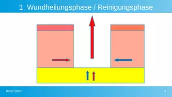 Vorschau - Präsentationen/Tafelbilder - Aufbau Haut und Wundheilungsphasen - Seite 2