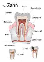 Vorschau - Spiele - Der Zahn - Legepuzzle | Biologie Klasse 6/7 - Seite 1