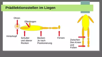 Vorschau - Präsentationen/Tafelbilder - Prädilektionsstellen Dekubitus - Seite 1