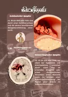 Vorschau - Poster - One Minute Wonder zu den Ursachen eines Schlaganfalles - Seite 3