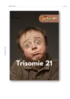 Vorschau - Arbeitsblätter - Down Syndrom: Was ist das Problem bei Trisomie 21? - Seite 1