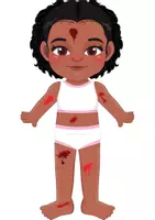 Vista previa - Juegos / Gamificación - ¡CURA MIS HERIDAS! - página 3