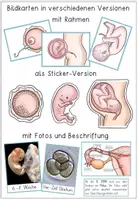 Vorschau - Präsentationen/Tafelbilder - Sexualerziehung - Bildkarten - Befruchtung / Schwangerschaft / Baby - neues Leben entsteht - Seite 1