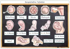 Vorschau - Präsentationen/Tafelbilder - Sexualerziehung - Bildkarten - Befruchtung / Schwangerschaft / Baby - neues Leben entsteht - Seite 2
