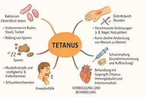 Vorschau - Arbeitsblätter - Arbeitsblätter zum Thema "Tetanus" + Lösung & MP3 + Mindmap + Infografik - Seite 2