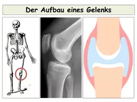 Vorschau - Stundenentwürfe - Gelenke des Menschen - Ganze Unterrichtsstunde Gelenkaufbau / Gelenktypen / Modellversuch: sofort einsetzbar! - Seite 3