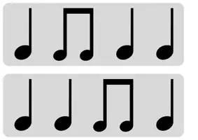 Vorschau - Fördermaterial/Inklusion - Symbole Rhythmen klatschen - Seite 1
