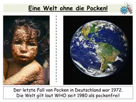 Vorschau - Stundenentwürfe - Immunisierung & Impfung - Der Fall Jenner | Aktive & passive Immunisierung inkl. Verlaufsplan & Lösungen - Seite 2