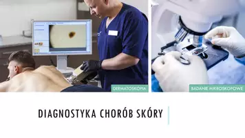 zapowiedź - Prezentacja - Choroby i higiena skóry - strona 1