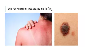 zapowiedź - Prezentacja - Choroby i higiena skóry - strona 2