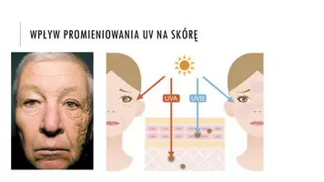 zapowiedź - Prezentacja - Choroby i higiena skóry - strona 3