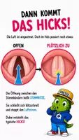 Vorschau - Bildkarten - Wie entsteht Schluckauf? - QUAPPIZ Kindernews - Seite 3