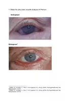 Vorschau - Unterrichtsreihen - Ektropium vs Entropium
Ursachen Symptome Behandlung - Seite 1