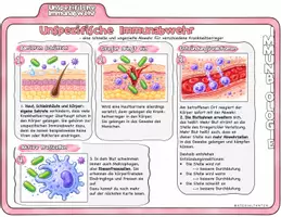 Vorschau - Stundenentwürfe - Unspezifische Immunabwehr / Immunbiologie - Seite 3
